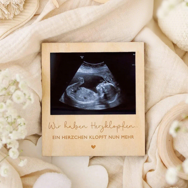 Ultrasound Pregnancy Announcem – Photo Booth Frame recenzja i cena